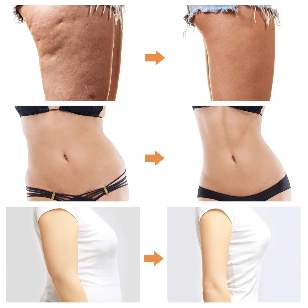 Liposuction Machine VE Sports Body Fitness
